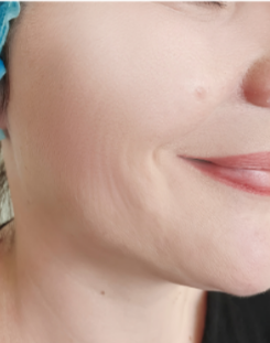 美容液を使用した後の肌の状態