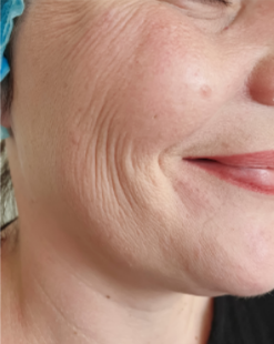 美容液を使用する前の肌の状態